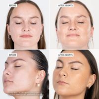 SKOON. HYDROSURGE Duo Pack – NanoPillow Serum + Activator Mist